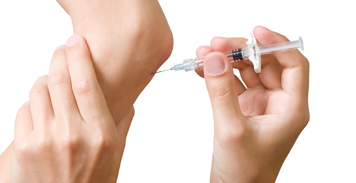 Präzise Injektion von Hyaluronsäure ins Gelenk - Therapie zur Verbesserung der Gelenkschmierung und Schmerzlinderung bei Arthrose und Gelenkabnutzung